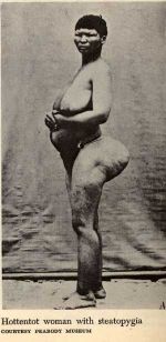 Steatopygia